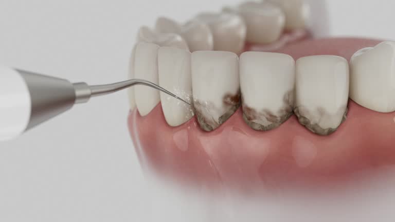 Trusted Teeth Cleaning And Checkup service in River Forest, IL - Dentist Open Now